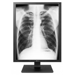 21.3 LG 21HK512D-B IPS 1000CD