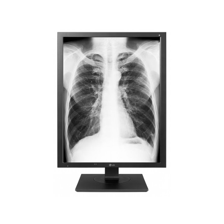 21.3 LG 21HK512D-B IPS 1000CD